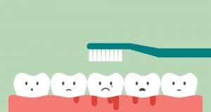 Cómo desinflamar las encías